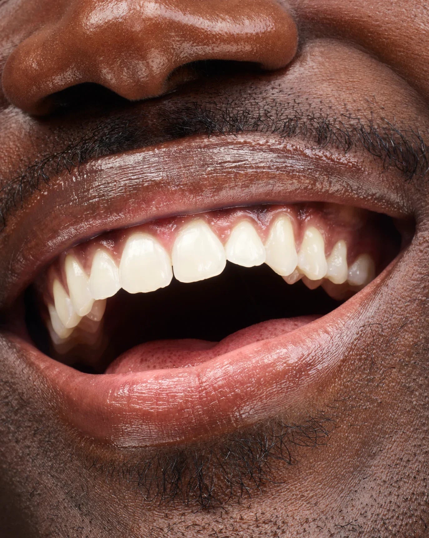 Glossier Balm Dotcom - Lip Balm - Glaze Türkiye